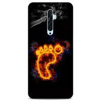 Lopard Oppo Reno 2z Uyumlu Kılıf FireX (15) Antişok Kılıf Foot