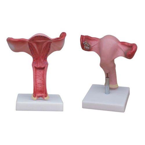 Uterus Modeli Büyük Boy