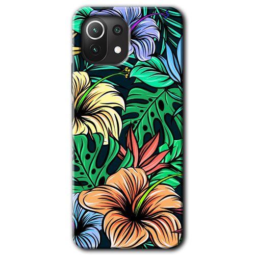 Xiaomi Mi 11 Kılıf HD Desen Baskılı Arka Kapak - Hibiscus Flowers