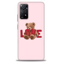 Xiaomi Redmi Note 11 Pro Kılıf HD Baskılı Kılıf - Love Bear + Tam Ekran Koruyucu