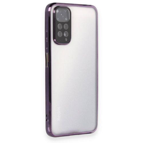 Xiaomi Redmi Note 11 Kılıf Razer Lensli Silikon