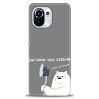Xiaomi Mi 11 Kılıf HD Baskılı Kılıf - Baltamın Ucu Keskindir + Tam Ekran Koruyucu