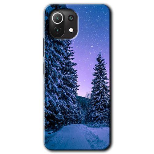 Xiaomi Mi 11 Lite Kılıf HD Desen Baskılı Arka Kapak - Kış Manzarası + Kırılmaz Cam