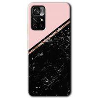 Xiaomi Redmi Note 11T Kılıf HD Desen Baskılı Arka Kapak + Temperli Cam - Yarım Mermer