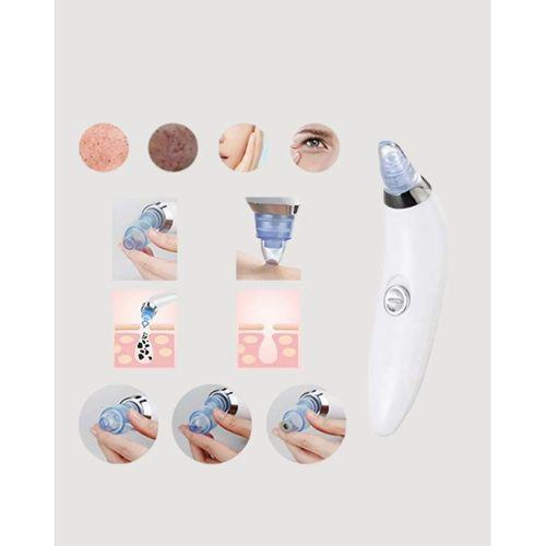 Vakum Teknolojili Siyah Nokta Temizleyici Cihaz – 4 Farklı Başlık Ve Derinlemesine Gözenek Temizliği