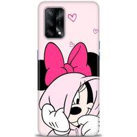 Oppo A74 Kılıf HD Baskılı Kılıf - Pink + Tam Ekran Koruyucu