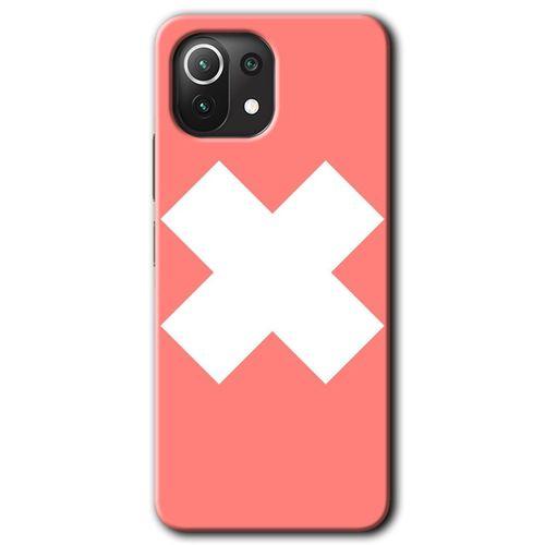 Xiaomi Mi 11 HD Baskılı Kılıf + 9D Tam Ekran Koruyucu - Close
