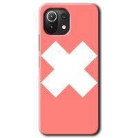 Xiaomi Mi 11 HD Baskılı Kılıf + 9D Tam Ekran Koruyucu - Close