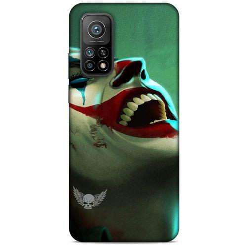 Xiaomi Mi 10T Pro 5G Uyumlu Kılıf Joker (36) Glitter Kılıf Camgöbeği mavisi