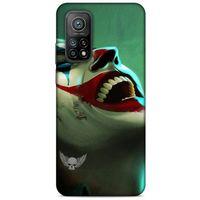 Xiaomi Mi 10T Pro 5G Uyumlu Kılıf Joker (36) Glitter Kılıf Camgöbeği mavisi