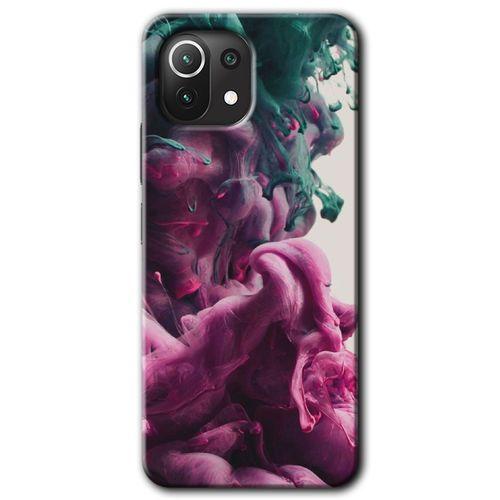 Xiaomi Mi 11 Lite Kılıf HD Desen Baskılı Arka Kapak + Temperli Cam - Liquid Cloud