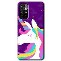 Redmi Note 11T Kılıf HD Desen Baskılı Arka Kapak - Unicorn Sleep