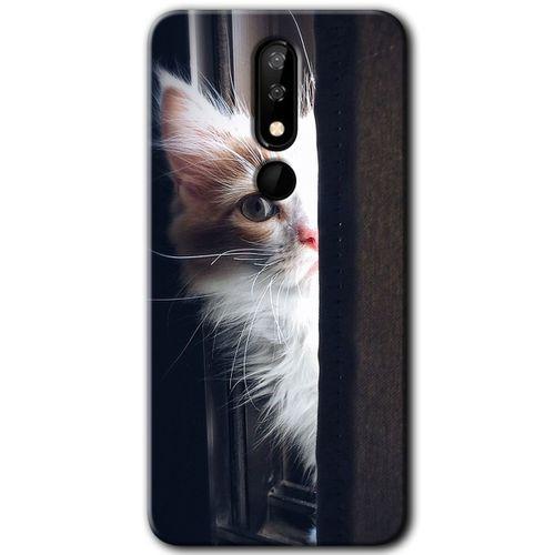 Casper Via P3 Kılıf HD Desen Baskılı Arka Kapak - Kedi Bakışı