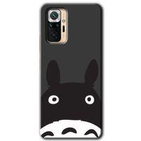 Redmi Note 10 Pro Kılıf HD Desen Baskılı Arka Kapak - Şaşkın Eşek + Kırılmaz Cam