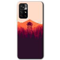 Redmi Note 11T Kılıf HD Desen Baskılı Arka Kapak - Gözlem Kulesi + Kırılmaz Cam