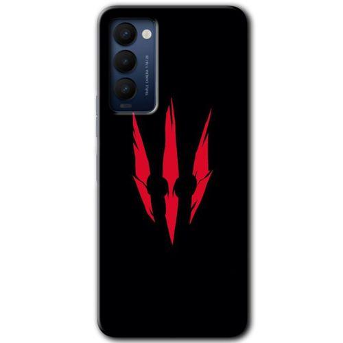 Tecno Camon 18 Kılıf HD Desen Baskılı Arka Kapak - Ayı Pençesi