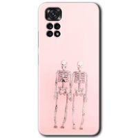 Redmi Note 11 5G Global Kılıf HD Desen Baskılı Arka Kapak - Yaşayan Çift