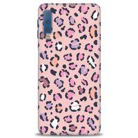 Samsung Galaxy A7 2018 Kılıf HD Baskılı Kılıf - Pembe Leopar + Tam Ekran Koruyucu