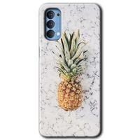 Oppo Reno 4 Kılıf Baskılı Kapak - Ananas + 5D Tam Kaplayan Cam