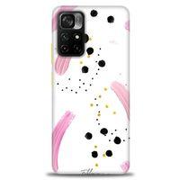 Xiaomi Redmi Note 11 Pro Plus Kılıf HD Baskılı Kılıf - Pembe ve Benekler + Tam Ekran Koruyucu