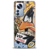 Xiaomi Mi 13 Pro Kılıf HD Baskılı Kılıf - Vip Only + Tam Ekran Koruyucu