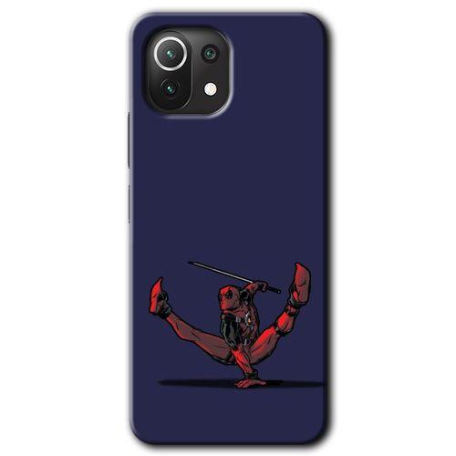 Xiaomi Mi 11 Lite Kılıf HD Desen Baskılı Arka Kapak + Temperli Cam - DeadPool 3