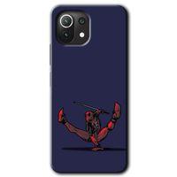 Xiaomi Mi 11 Lite Kılıf HD Desen Baskılı Arka Kapak + Temperli Cam - DeadPool 3