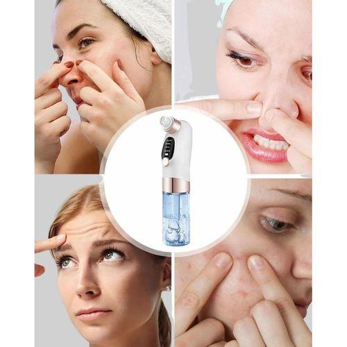 Elektrikli Siyah Nokta Sökücü – Derinlemesine Gözenek Temizleme Cihazı