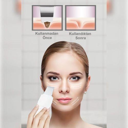 Ultrasonıc Siyah Nokta Akne Spatula Cilt Temizleyici