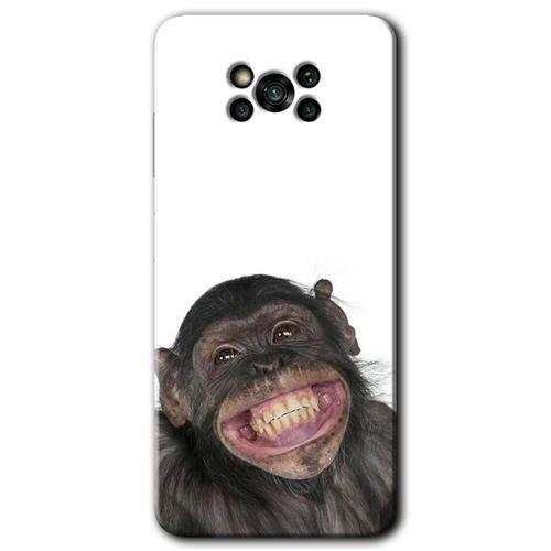 Poco x3 Pro Kılıf HD Desen Baskılı Arka Kapak + Temperli Cam - Şıpsevdi Aşk