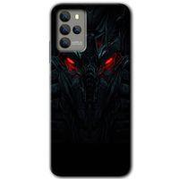 Omix X700 Kılıf HD Desen Baskılı Arka Kapak - Vinicius