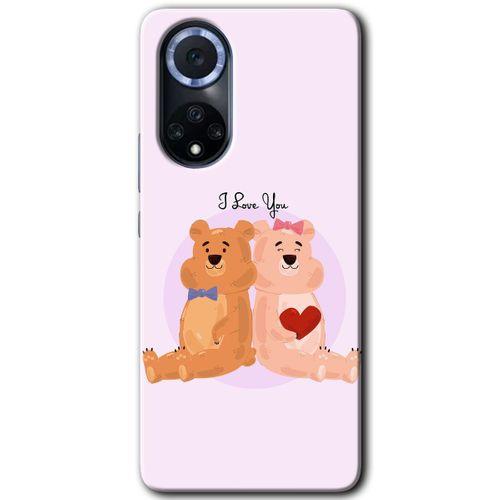 MRCİLETİSİM Huawei Nova 9 Kılıf HD Desen Baskılı Arka Kapak+Temperli Cam - Sevgili Ayıcık