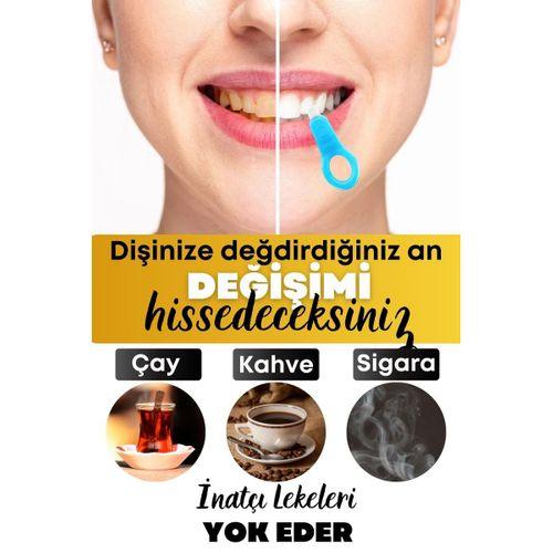 Magic Kit Diş Leke Silgisi 1 Aparatlı + 5 Yedek Süngerli Set X 2 Adet