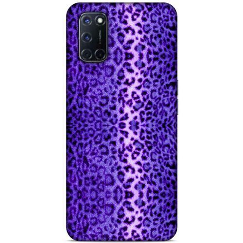 Leopar Mor Samsung Galaxy A70 Kılıf