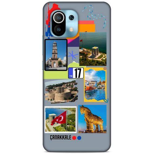 Lopard Xiaomi Mi 11 Uyumlu Kılıf Şehirli ※ (17) Tasarım Kılıf Çanakkale