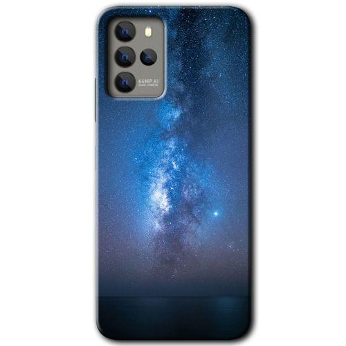 Omix X700 Kılıf HD Desen Baskılı Arka Kapak - Samanyolu