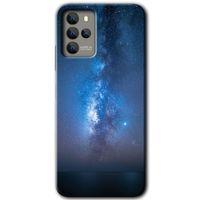 Omix X700 Kılıf HD Desen Baskılı Arka Kapak - Samanyolu