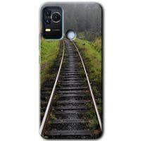 Omix X400 Kılıf HD Desen Baskılı Arka Kapak - Tren Yolu