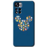 Redmi Note 11 Pro Plus 5G Kılıf HD Desen Baskılı Arka Kapak - Mickey + Kırılmaz Cam