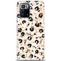 Xiaomi Poco X3 GT Kılıf HD Baskılı Kılıf - Leopar + Tam Ekran Koruyucu
