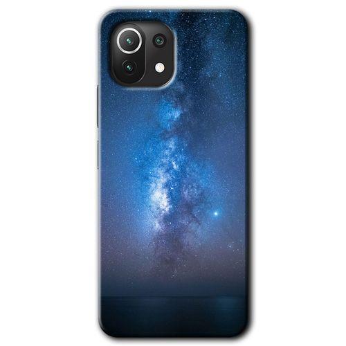 Xiaomi Mi 11 Lite Kılıf Baskılı Arka Kapak - Samanyolu +Tam Ekran Koruyucu