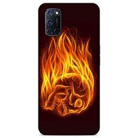 Lopard Oppo A52 Uyumlu Kılıf FireX (50) Shockproof Kılıf İskelet Kafa