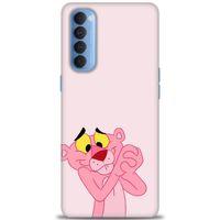Oppo Reno 4 Pro Kılıf HD Baskılı Kılıf - Pembe Panter + Tam Ekran Koruyucu
