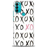 General Mobile GM 21 Plus Kılıf HD Baskılı Kılıf - XOXO + Tam Ekran Koruyucu