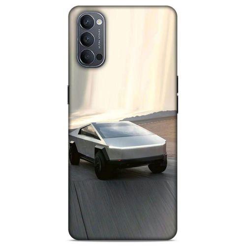 Lopard Oppo Reno 4 Uyumlu Kılıf PickUpX (17) Tasarım Kılıf Gümüş Gri