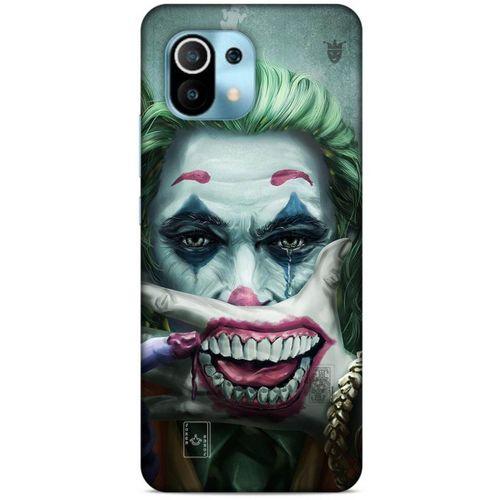 Xiaomi Mi 11 Uyumlu Kılıf Joker (49) Ultra Silikon Kılıf Kobalt
