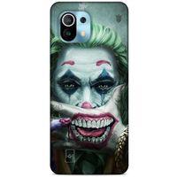 Xiaomi Mi 11 Uyumlu Kılıf Joker (49) Ultra Silikon Kılıf Kobalt