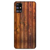 Lopard Samsung Galaxy M31s Uyumlu Kılıf Wood'X (10) Full Koruma Kılıfı Desenli