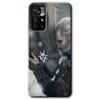 Redmi Note 11T Kılıf HD Desen Baskılı Arka Kapak - Kadim Dost + Kırılmaz Cam