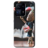 Mi Mix 4 Kılıf HD Desen Baskılı Arka Kapak - I am Groot